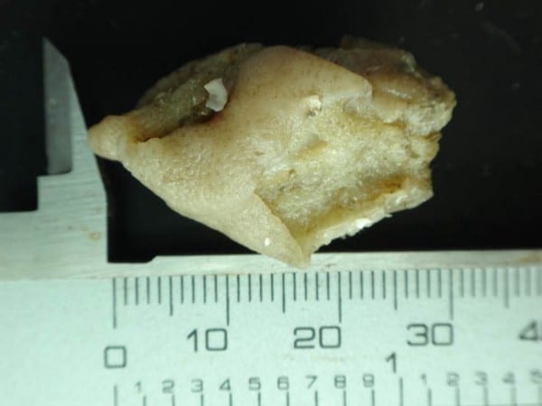 Fragment of Geodia sponge from Kemp’s ridley diet sample